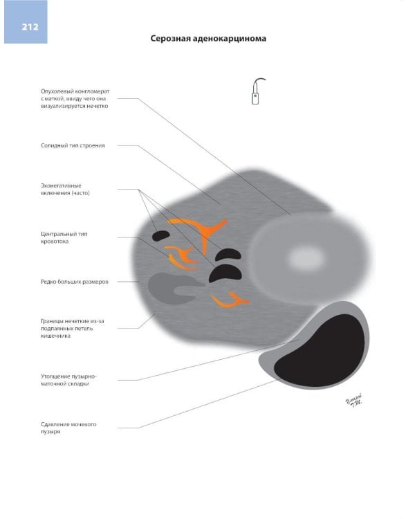 Атлас по ультразвуковой диагностике в гинекологии. 4-е изд