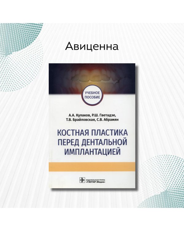 Костная пластика перед дентальной имплантацией. Учебное пособие