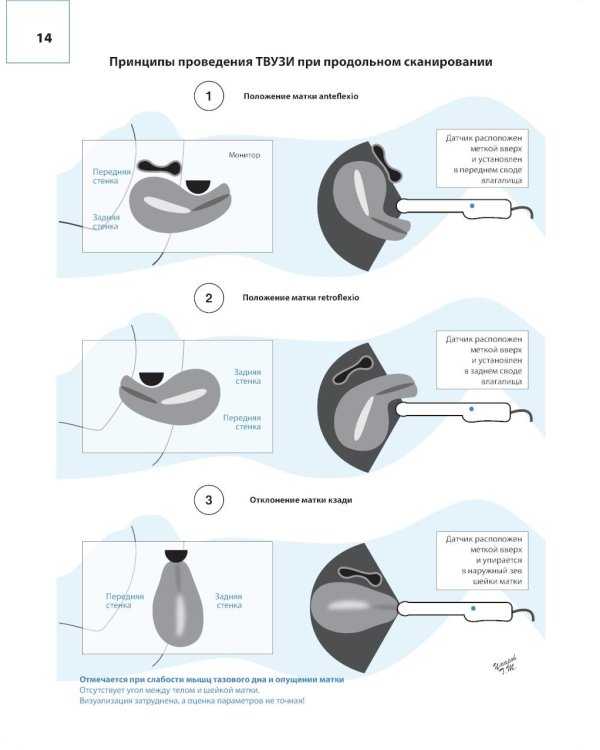 Атлас по ультразвуковой диагностике в гинекологии. 4-е изд