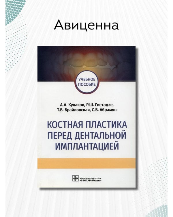 Костная пластика перед дентальной имплантацией. Учебное пособие