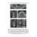 Костная пластика перед дентальной имплантацией: Учебное пособие Костная пластика перед дентальной имплантацией: Учебное пособие