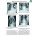 Рентгенология. Техника исследований и анализ изображений. В 2 ч. (комплект из 2 кн.) Рентгенология. Техника исследований и анализ изображений. В 2 ч. (комплект из 2 кн.)