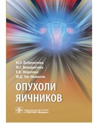 Опухоли яичников: руководство