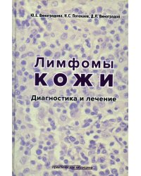 Лимфомы кожи: Диагностика и лечение
