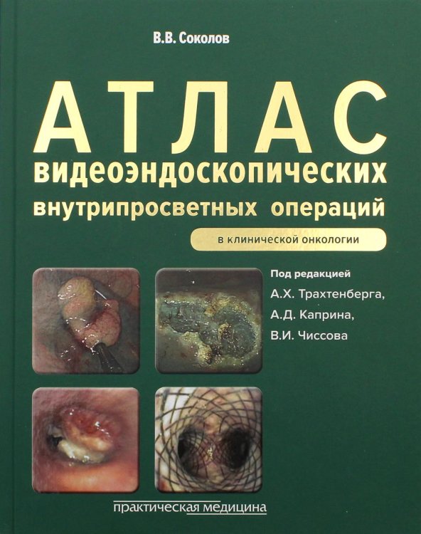 Атлас видеоэндоскопических внутрипросветных операций в клинической онкологии