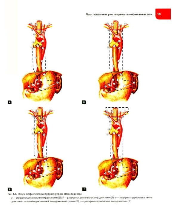 Атлас операций при злокачественных опухолях пищевода и желудка (обл.)