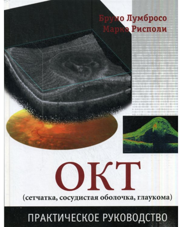 ОКТ (сетчатка, сосудистая оболочка, глаукома). Практическое руководство
