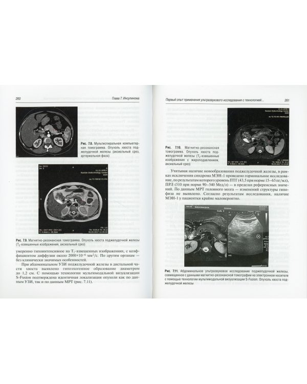 Персонализированная эндокринология в клинических примерах