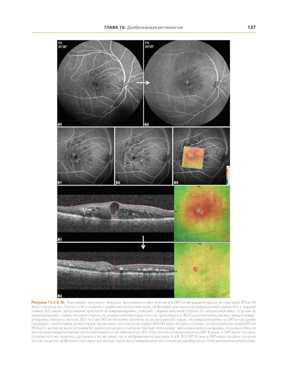 ОКТ-ангиография. Клинический атлас
