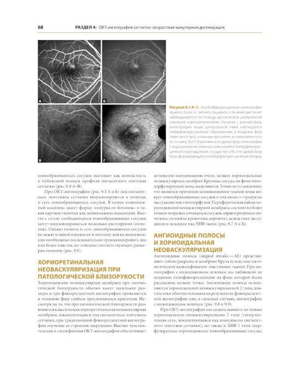 ОКТ-ангиография. Клинический атлас