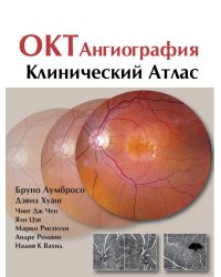ОКТ-ангиография. Клинический атлас