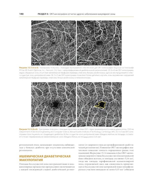 ОКТ-ангиография. Клинический атлас