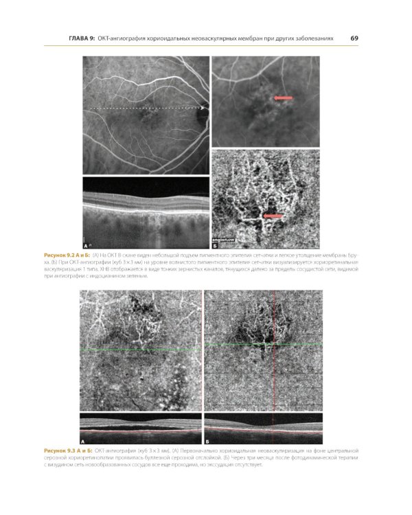 ОКТ-ангиография. Клинический атлас