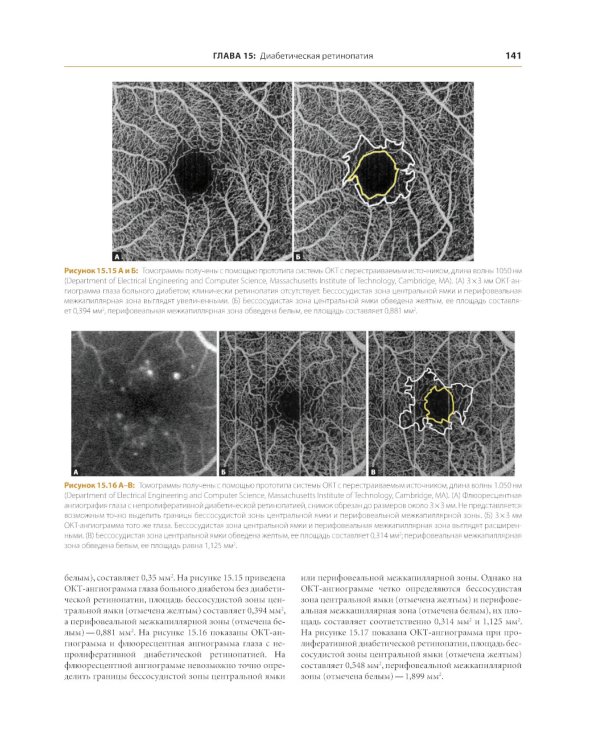 ОКТ-ангиография. Клинический атлас