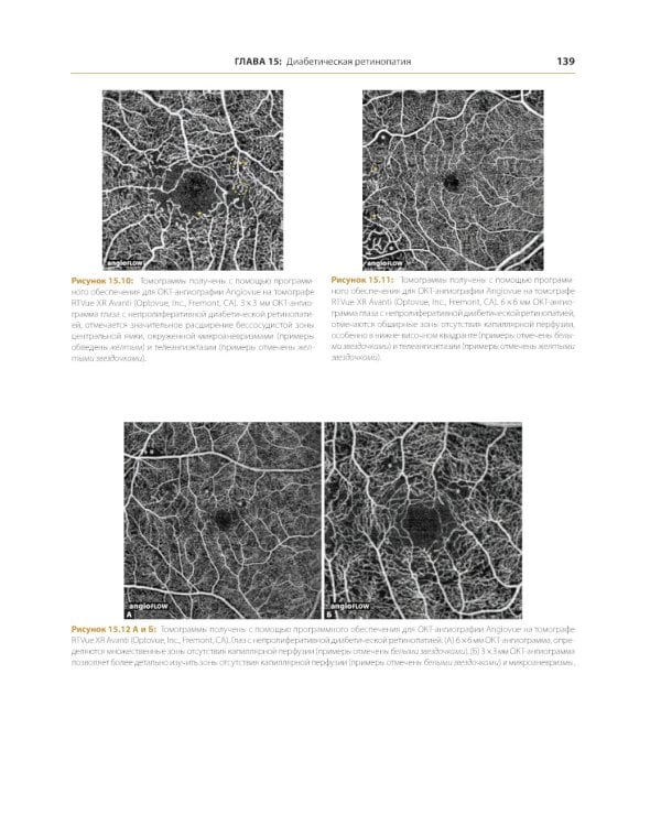 ОКТ-ангиография. Клинический атлас