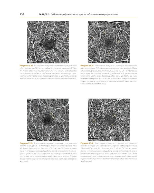 ОКТ-ангиография. Клинический атлас
