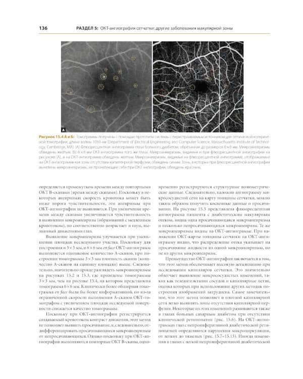 ОКТ-ангиография. Клинический атлас