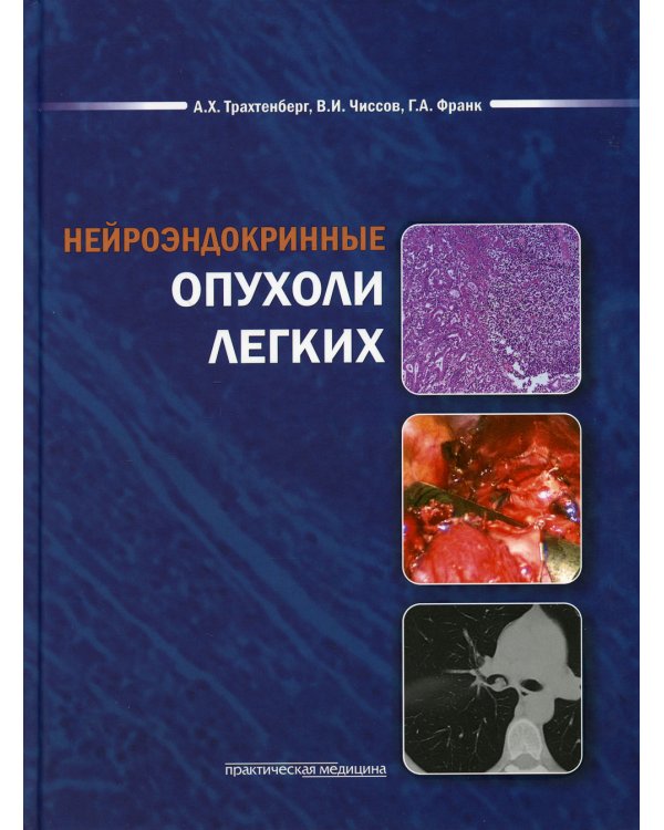 Нейроэндокринные опухоли легких