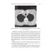 Профессиональные болезни и военно-полевая терапия: Учебник. 2-е изд., перераб