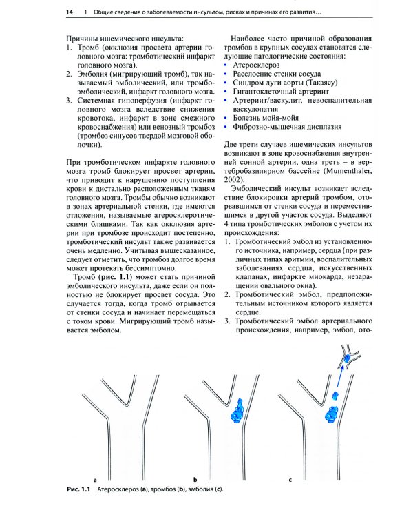 Ранняя реабилитация после инсульта. 3-е изд