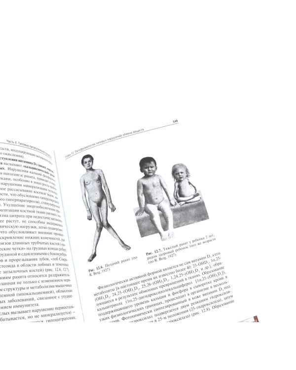 Патофизиология: Учебник. В 2 т. Т. 1. 5-е изд., перераб. и доп