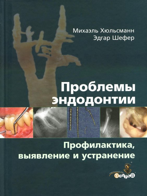 Проблемы эндодонтии. Профилактика, выявление и устранение Проблемы эндодонтии. Профилактика, выявление и устранение