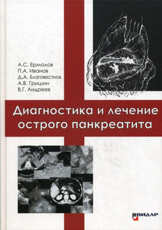 Диагностика и лечение острого панкреатита Диагностика и лечение острого панкреатита