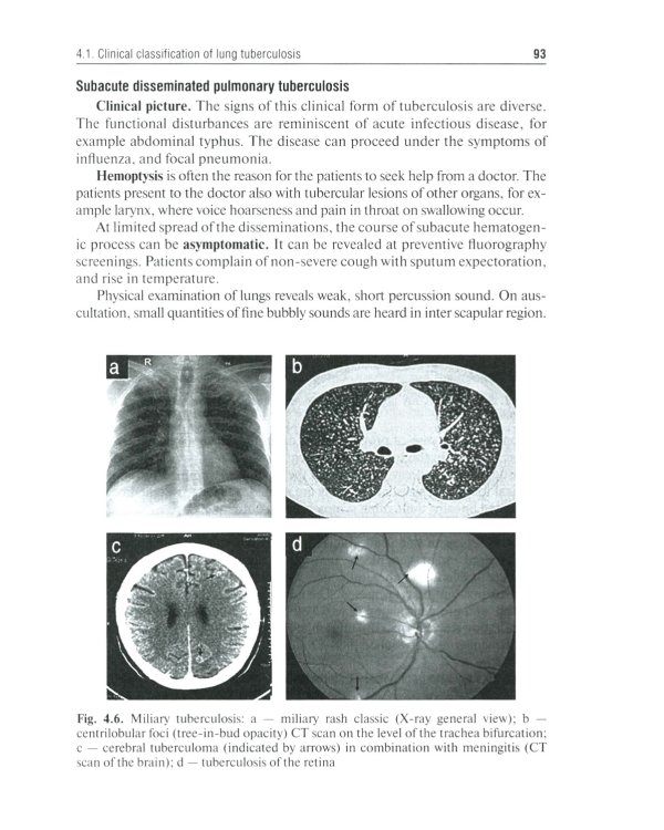 Phthisiatry: textbook = Фтизиатрия: Учебник