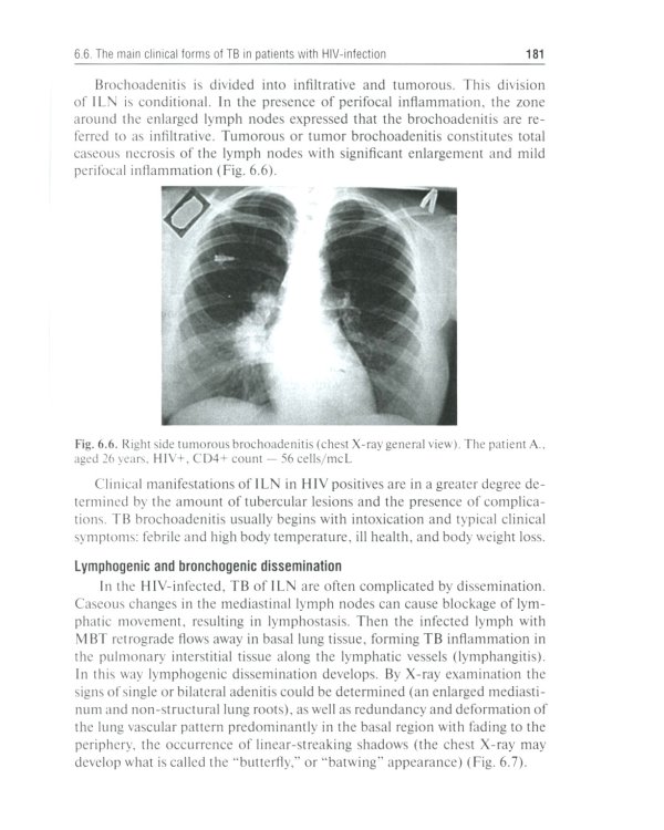 Phthisiatry: textbook = Фтизиатрия: Учебник
