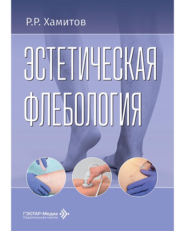 Эстетическая флебология