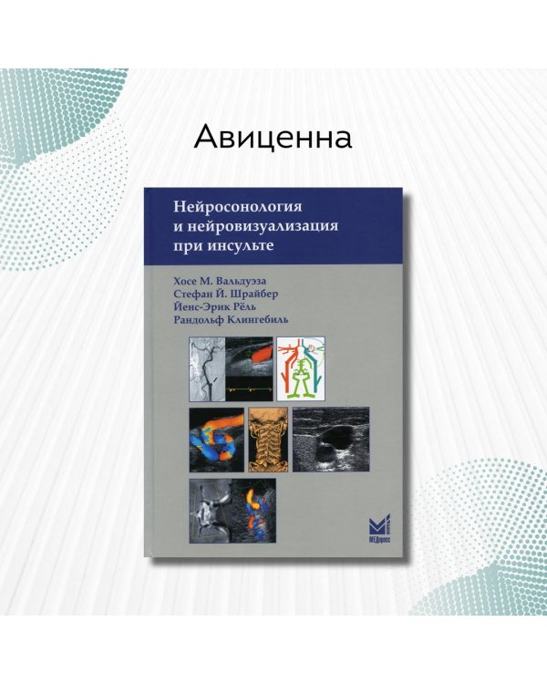 Нейросонология и нейровизуализация при инсульте