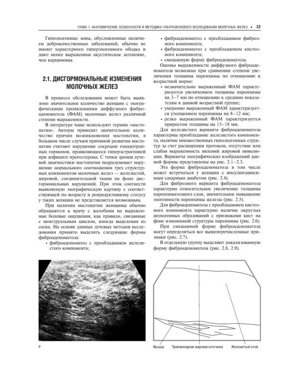 Практическая ультразвуковая диагностика: Руководство для врачей. В 5 т. Т. 5. Ультразвуковая диагностика заболеваний молочных желез и мягких тканей
