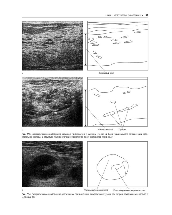 Практическая ультразвуковая диагностика: Руководство для врачей. В 5 т. Т. 5. Ультразвуковая диагностика заболеваний молочных желез и мягких тканей