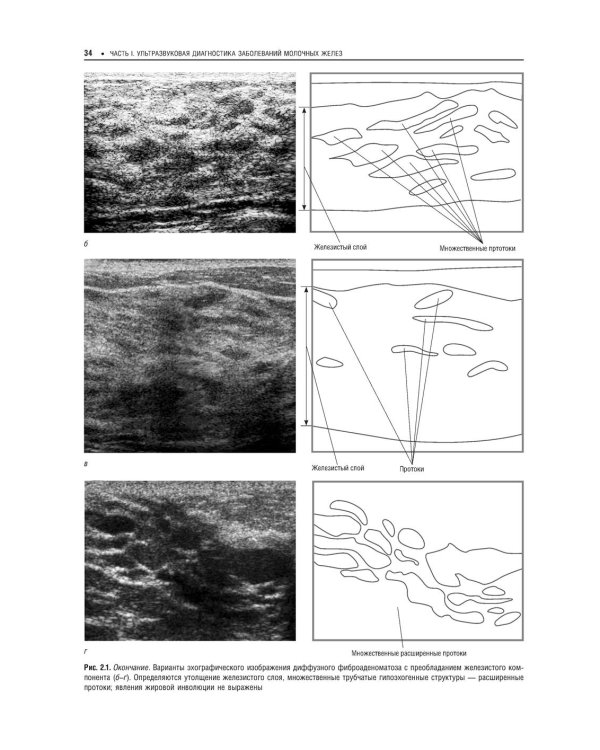 Практическая ультразвуковая диагностика: Руководство для врачей. В 5 т. Т. 5. Ультразвуковая диагностика заболеваний молочных желез и мягких тканей