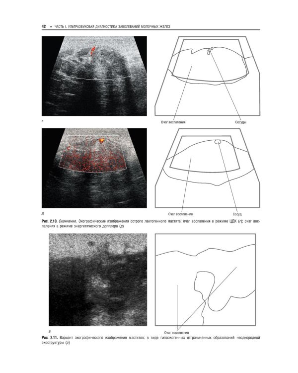 Практическая ультразвуковая диагностика: Руководство для врачей. В 5 т. Т. 5. Ультразвуковая диагностика заболеваний молочных желез и мягких тканей