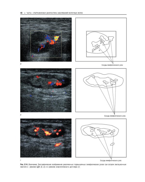 Практическая ультразвуковая диагностика: Руководство для врачей. В 5 т. Т. 5. Ультразвуковая диагностика заболеваний молочных желез и мягких тканей