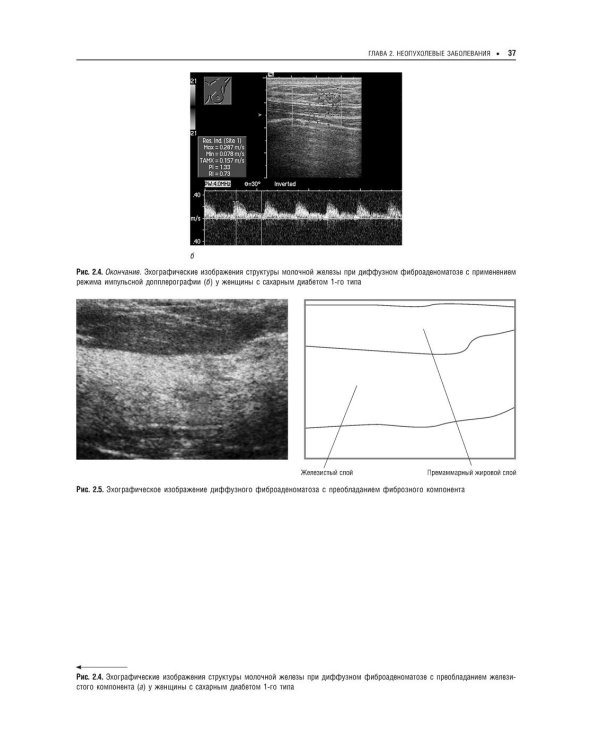 Практическая ультразвуковая диагностика: Руководство для врачей. В 5 т. Т. 5. Ультразвуковая диагностика заболеваний молочных желез и мягких тканей