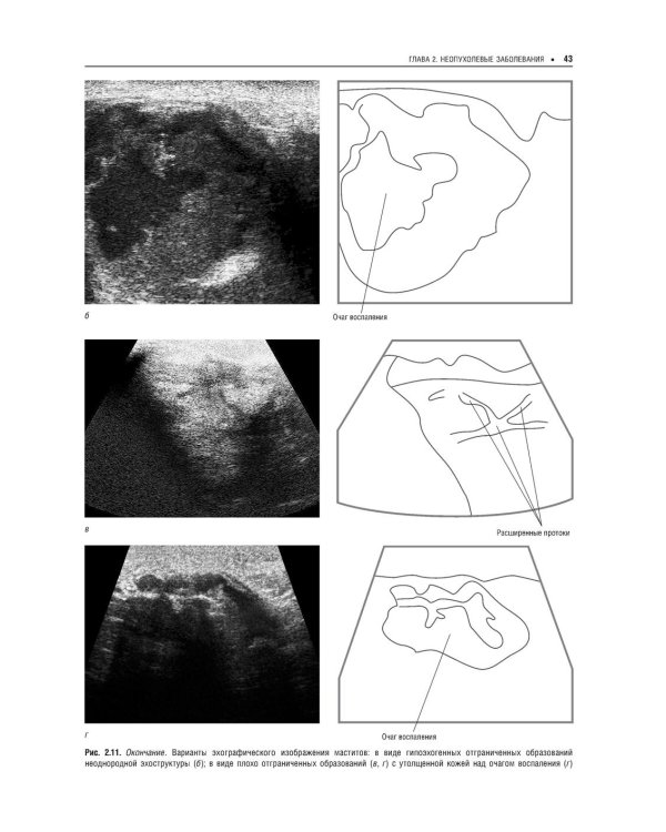 Практическая ультразвуковая диагностика: Руководство для врачей. В 5 т. Т. 5. Ультразвуковая диагностика заболеваний молочных желез и мягких тканей