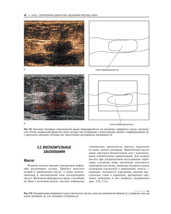 Практическая ультразвуковая диагностика: Руководство для врачей. В 5 т. Т. 5. Ультразвуковая диагностика заболеваний молочных желез и мягких тканей