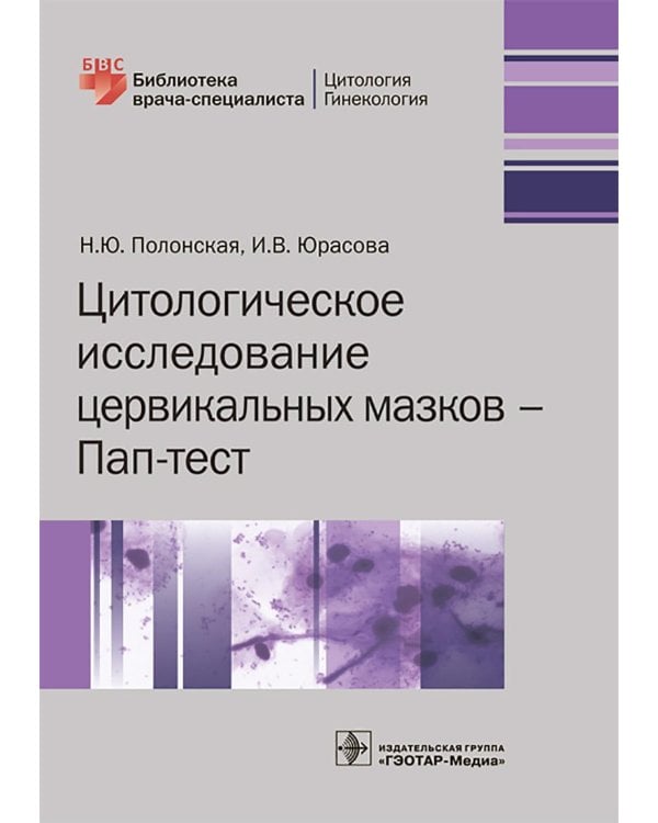 Цитологическое исследование цервикальных мазков — Пап-тест