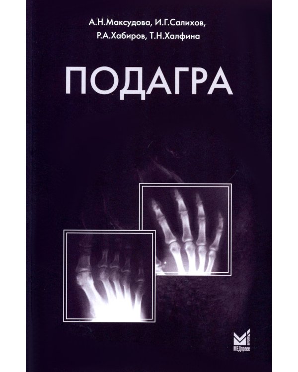 Подагра. 4-е изд