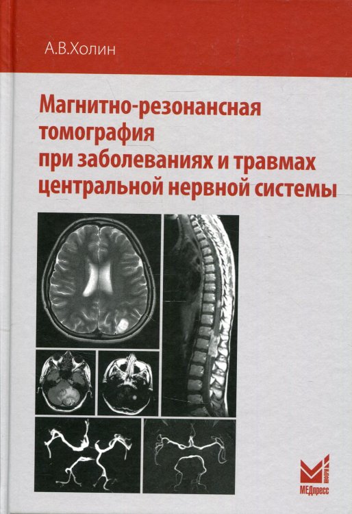 Магнитно-резонансная томография при заболеваниях и травмах центральной нервной системы. 2-е изд Магнитно-резонансная томография при заболеваниях и травмах центральной нервной системы. 2-е изд