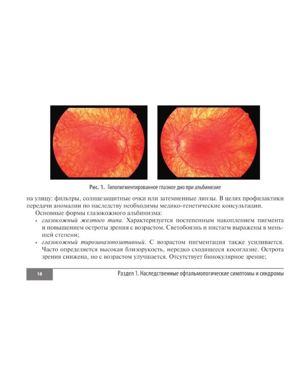 Симптомы и синдромы в офтальмологии. 2-е изд., перераб. и доп