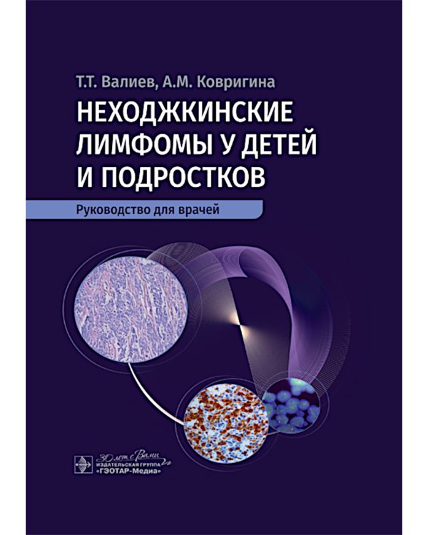 Неходжкинские лимфомы у детей и подростков: руководство для врачей