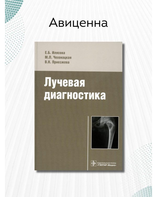 Лучевая диагностика