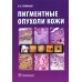 Пигментные опухоли кожи