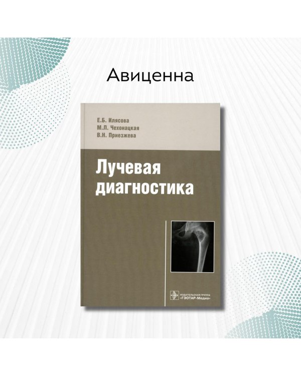 Лучевая диагностика