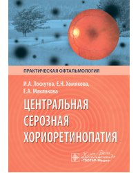 Центральная серозная хориоретинопатия