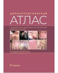 Дерматологический атлас. 2-е изд., доп