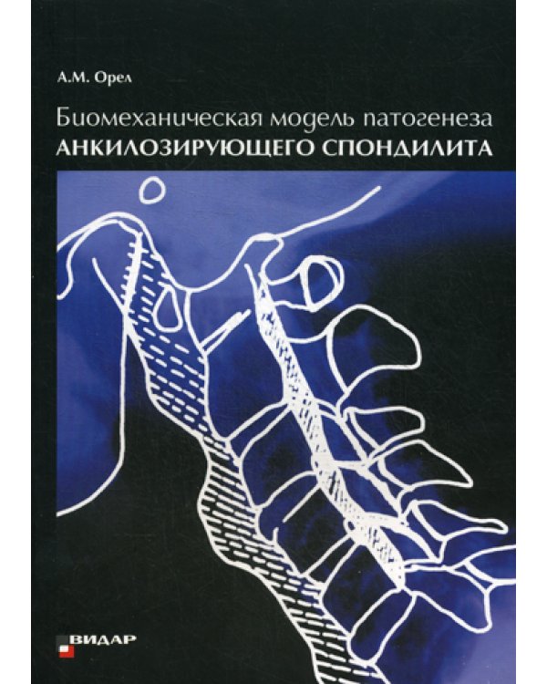 Биомеханическая модель патогенеза акилозирующего спондилита